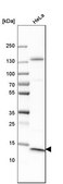 Anti-CT83 antibody produced in rabbit Prestige Antibodies® Powered by Atlas Antibodies, affinity isolated antibody, buffered aqueous glycerol solution