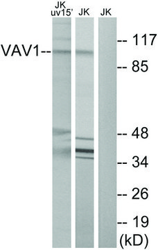 Anti-VAV1 antibody produced in rabbit affinity isolated antibody