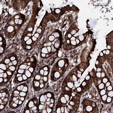 Anti-SDHAF2 antibody produced in rabbit Prestige Antibodies&#174; Powered by Atlas Antibodies, affinity isolated antibody, buffered aqueous glycerol solution