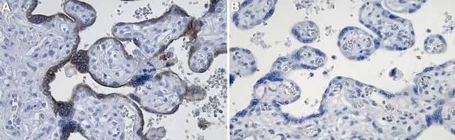 Anti-Aromatase Antibody, clone 1D23 ZooMAb&#174; Rabbit Monoclonal recombinant, expressed in HEK 293 cells