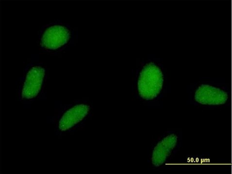 抗 SPOP 小鼠抗 purified immunoglobulin, buffered aqueous solution