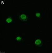 Anti-SLFN11 Antibody, clone 3E13 ZooMAb® Rabbit Monoclonal recombinant, expressed in HEK 293 cells