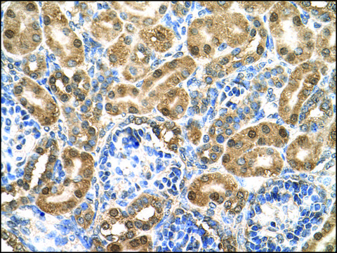 Anti-ENO3 (AB2) antibody produced in rabbit IgG fraction of antiserum