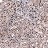 Anti-TNRC6A antibody produced in rabbit Prestige Antibodies® Powered by Atlas Antibodies, affinity isolated antibody, buffered aqueous glycerol solution