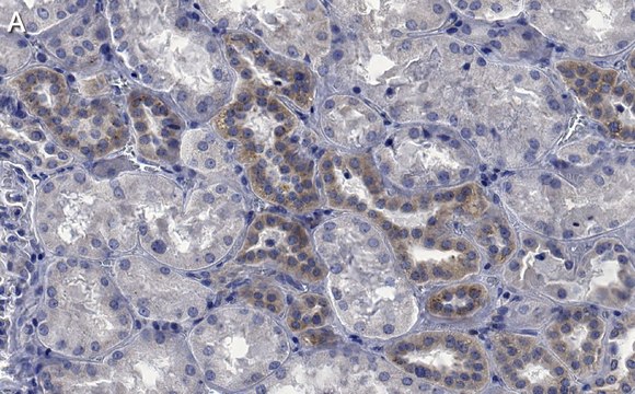 Anti-STX17 Antibody, clone 1B3 ZooMAb&#174; Rabbit Monoclonal recombinant, expressed in HEK 293 cells