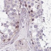 Anti-TMEM237 antibody produced in rabbit Prestige Antibodies® Powered by Atlas Antibodies, affinity isolated antibody, buffered aqueous glycerol solution