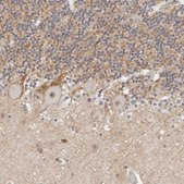 Anti-TSEN2 antibody produced in rabbit Prestige Antibodies® Powered by Atlas Antibodies, affinity isolated antibody, buffered aqueous glycerol solution, ab2