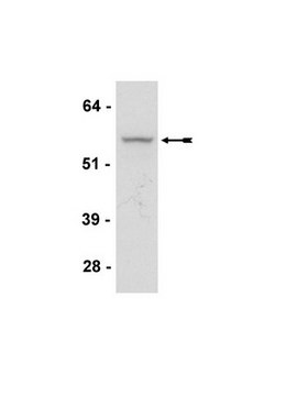 Anti-Akt3/PKB&#947; Antibody, clone GMA104 clone GMA104, Upstate&#174;, from mouse