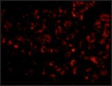 Anti-Albumin antibody produced in chicken affinity isolated antibody, buffered aqueous solution