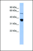 Anti-RAD23B antibody produced in rabbit affinity isolated antibody