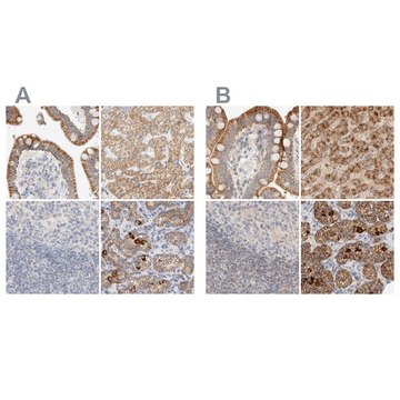 Anti-HDHD3 antibody produced in rabbit Prestige Antibodies&#174; Powered by Atlas Antibodies, affinity isolated antibody, buffered aqueous glycerol solution, Ab2