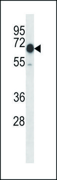 ANTI-MOUSE CAMKK2 (N-TERM) antibody produced in rabbit IgG fraction of antiserum, buffered aqueous solution