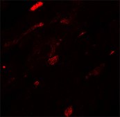 Anti-TGM5 antibody produced in rabbit affinity isolated antibody