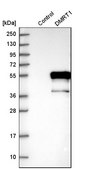 Anti-DMRT1 antibody produced in rabbit Prestige Antibodies® Powered by Atlas Antibodies, affinity isolated antibody, buffered aqueous glycerol solution