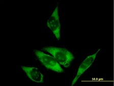 Anti-RPL29 antibody produced in mouse IgG fraction of antiserum, buffered aqueous solution