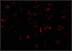 Anti-NALP1 antibody produced in rabbit affinity isolated antibody, buffered aqueous solution