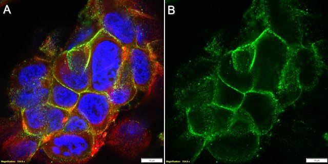 Anti-E-Cadherin/CD324 Antibody, clone 19A11