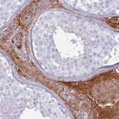 Anti-TPPP3 antibody produced in rabbit Prestige Antibodies® Powered by Atlas Antibodies, affinity isolated antibody, buffered aqueous glycerol solution