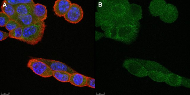 Anti-CD36 Antibody, clone ZND36-6