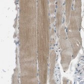 Anti-MAGI2 antibody produced in rabbit Prestige Antibodies® Powered by Atlas Antibodies, affinity isolated antibody, buffered aqueous glycerol solution