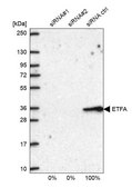 Anti-ETFA antibody produced in rabbit Prestige Antibodies® Powered by Atlas Antibodies, affinity isolated antibody, buffered aqueous glycerol solution