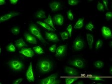 Monoclonal Anti-KRTHB1 antibody produced in mouse clone 3B10-5B10, purified immunoglobulin, buffered aqueous solution