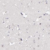 Anti-F13B antibody produced in rabbit Prestige Antibodies® Powered by Atlas Antibodies, affinity isolated antibody, buffered aqueous glycerol solution