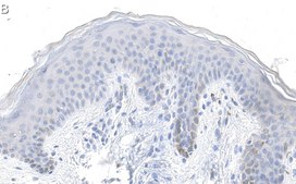 Anti-Laminin-5 γ2 Antibody, clone D4B5 ZooMAb® Mouse Monoclonal recombinant, expressed in HEK 293 cells