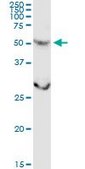 Anti-CSGALNACT2 antibody produced in rabbit purified immunoglobulin, buffered aqueous solution