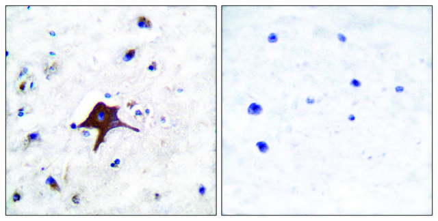 Anti-GLUT3, C-Terminal antibody produced in rabbit affinity isolated antibody