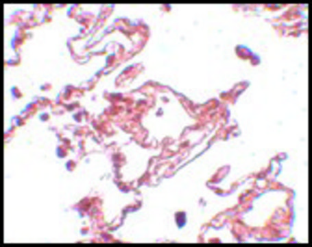 Anti-CCDC69 antibody produced in chicken affinity isolated antibody, buffered aqueous solution