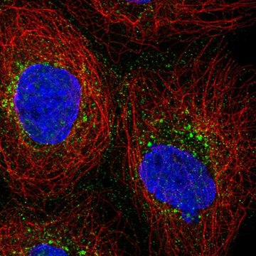 Anti-PRPS2 antibody produced in rabbit Prestige Antibodies&#174; Powered by Atlas Antibodies, affinity isolated antibody