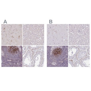 抗-TMEM119 兔抗 Prestige Antibodies&#174; Powered by Atlas Antibodies, affinity isolated antibody, buffered aqueous glycerol solution