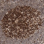 Anti-CHAF1B antibody produced in rabbit Prestige Antibodies® Powered by Atlas Antibodies, affinity isolated antibody, buffered aqueous glycerol solution