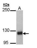Anti-SCAP (C-terminal) antibody produced in rabbit affinity isolated antibody, buffered aqueous solution