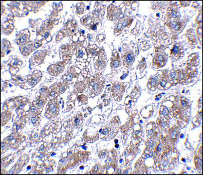 Anti-MATN1 antibody produced in rabbit affinity isolated antibody, buffered aqueous solution, ab1