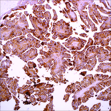 Mesothelin (EP140) Rabbit Monoclonal Primary Antibody