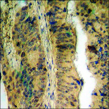 Anti-phospho-ERF (pThr526) antibody produced in rabbit affinity isolated antibody