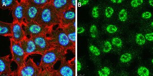 Anti-TET2 Antibody, clone 4L14 ZooMAb® Rabbit Monoclonal recombinant, expressed in HEK 293 cells