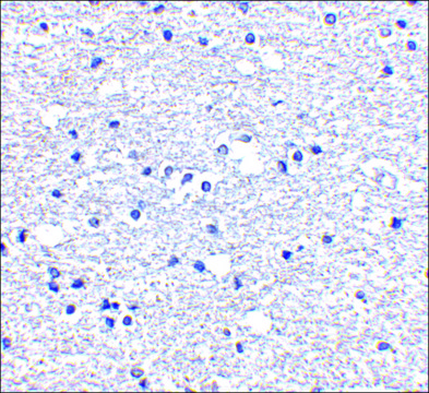 Anti-PD-1 (ab2) antibody produced in rabbit affinity isolated antibody, buffered aqueous solution