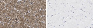 Anti-K+/Cl- Cotransporter-2 Antibody, clone 5E13 ZooMAb® Rabbit Monoclonal recombinant, expressed in HEK 293 cells