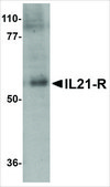 Anti-IL-21 Receptor (ab2) antibody produced in rabbit affinity isolated antibody, buffered aqueous solution