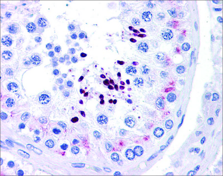 Anti-CCND1 (ab3) antibody produced in rabbit affinity isolated antibody