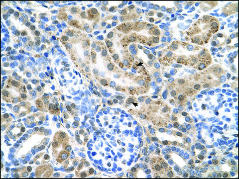 Anti-SLC22A3 affinity isolated antibody