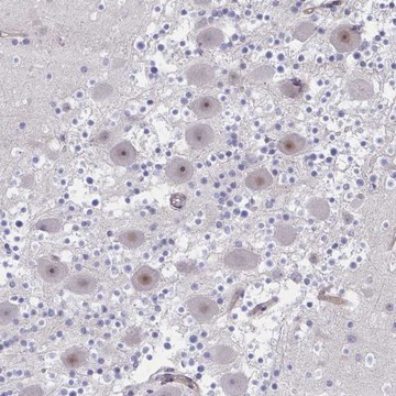 Anti-CENPQ antibody produced in rabbit Prestige Antibodies&#174; Powered by Atlas Antibodies, affinity isolated antibody, buffered aqueous glycerol solution