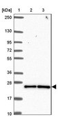 Anti-CCDC12 antibody produced in rabbit Prestige Antibodies® Powered by Atlas Antibodies, affinity isolated antibody, buffered aqueous glycerol solution