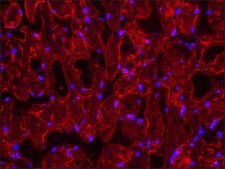 Anti-Dysferlin (N-terminal) antibody produced in rabbit ~1.0 mg/mL, affinity isolated antibody, antigen mol wt ~250 kDa
