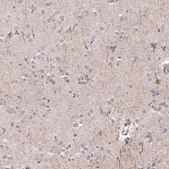 Monoclonal Anti-P2RX7 antibody produced in mouse Prestige Antibodies® Powered by Atlas Antibodies, clone CL11508, purified antibody (Protein A)