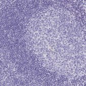 Anti-AQP6 antibody produced in rabbit Prestige Antibodies® Powered by Atlas Antibodies, affinity isolated antibody, buffered aqueous glycerol solution
