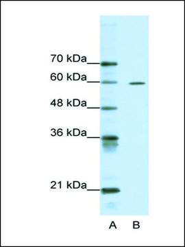 Anti-ARID3A antibody produced in rabbit affinity isolated antibody